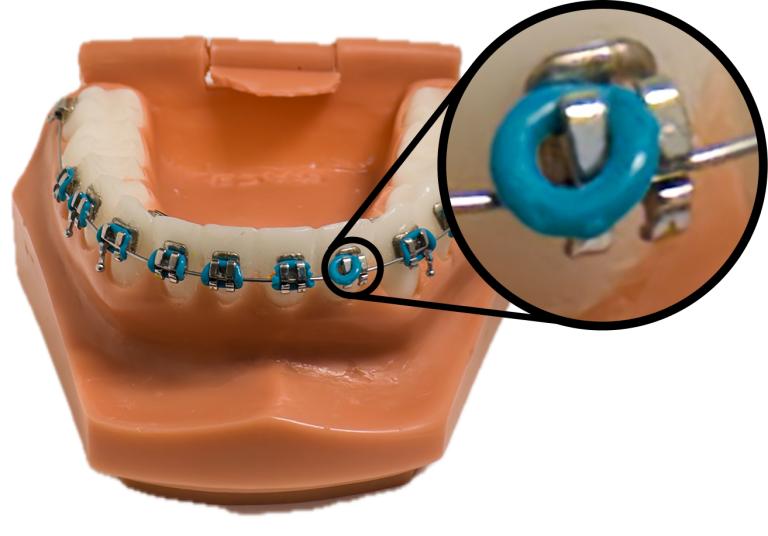 Close-up of a color tie on a bracket