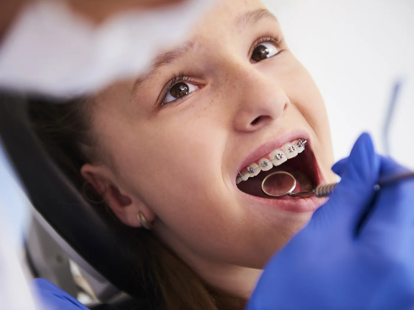 Orthodontics at Alameda Pediatric Dentistry & Orthodontics